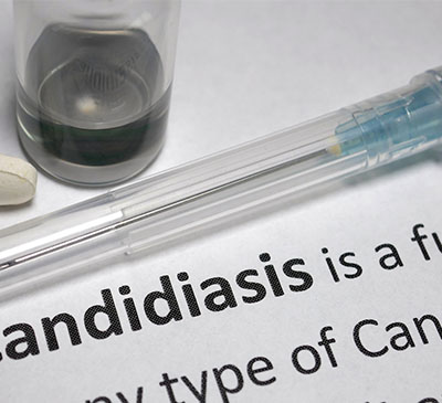 Global Candidiasis Drugs Market 2019-2023